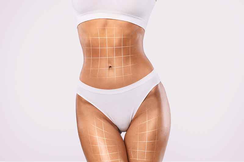 Liposuction in Nova Scotia: Sculpt Your Dream Body with Our Trusted Surgeons